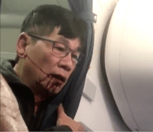 UNITED AIRLINES HIT AND DRAGGED OFF A PASSENGER FROM THE PLANE!!!